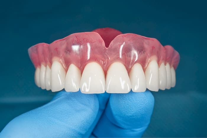 Rehabilitacion Oral